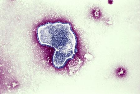 　ＲＳウイルスの電子顕微鏡写真（ゲッティ＝共同）