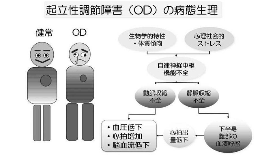 田中英高：小児のめまい・平衡障害―コロナ禍に発症しやすい起立性調節障害―小児耳２０２２；４３（１）：５１－５６より引用