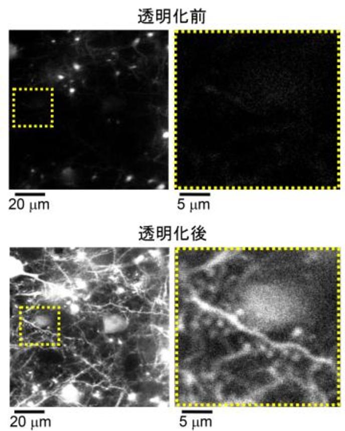 　観察したマウスの大脳皮質（九州大稲垣成矩助教、今井猛主幹教授提供）