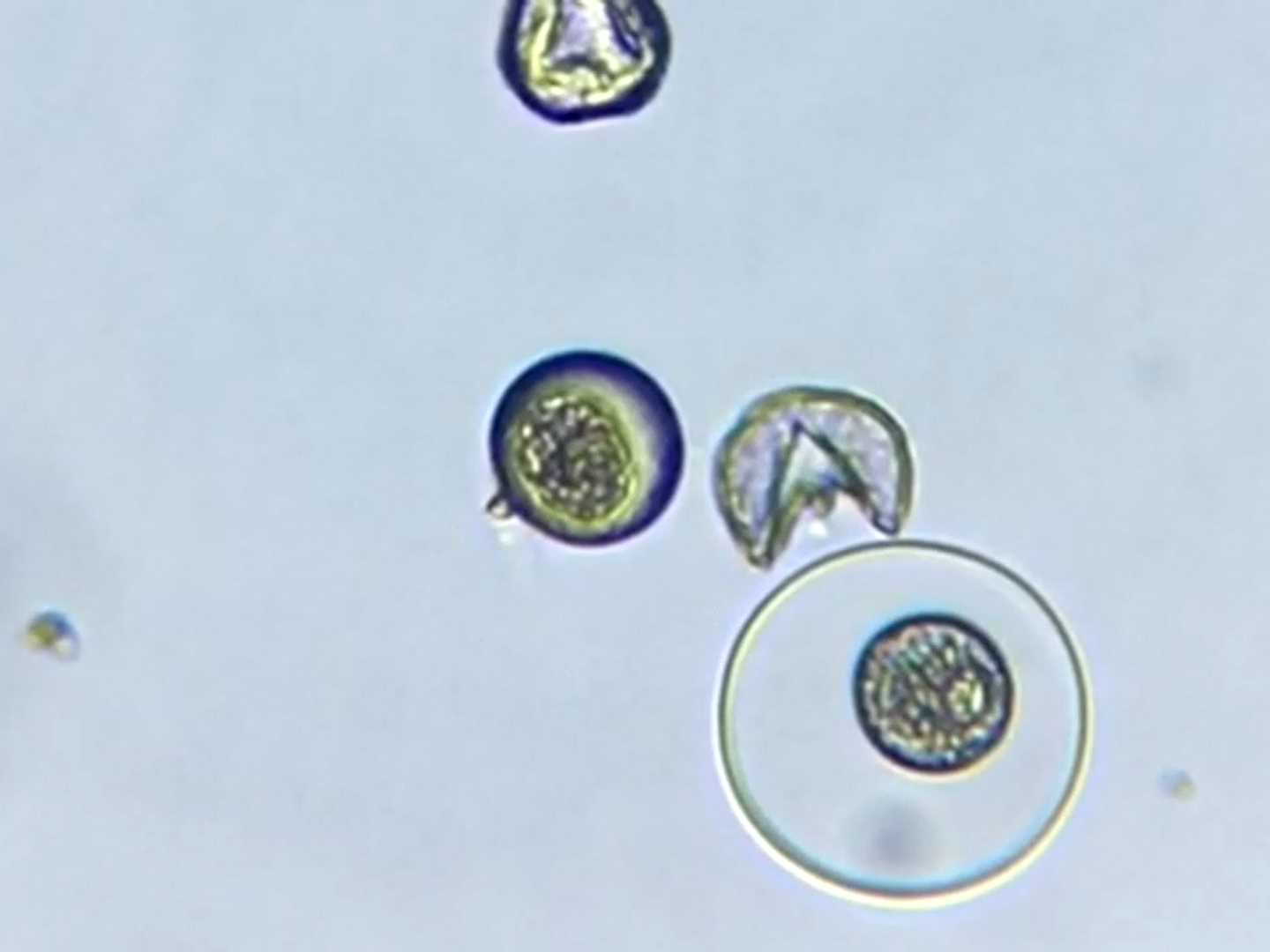顕微鏡で見た花粉。水に触れて破裂する様子が確認できた
