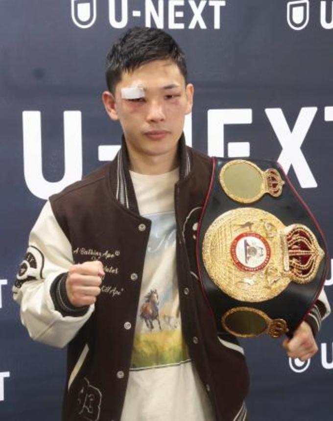 　ＷＢＡミニマム級王座初防衛から一夜明け、ポーズをとる松本流星＝１６日、東京都新宿区の帝拳ジム