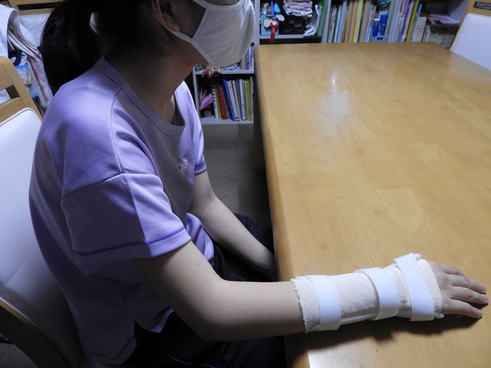 自転車に衝突される事故に遭った女子生徒。右手には包帯が巻かれている＝不破郡垂井町