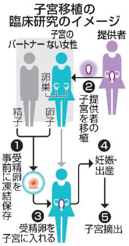 　子宮移植の臨床研究のイメージ