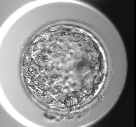 　塩基編集でＮＡＮＯＧ遺伝子を改変した人の受精卵（ケンブリッジ大ローク栄養胚葉研究センター提供）