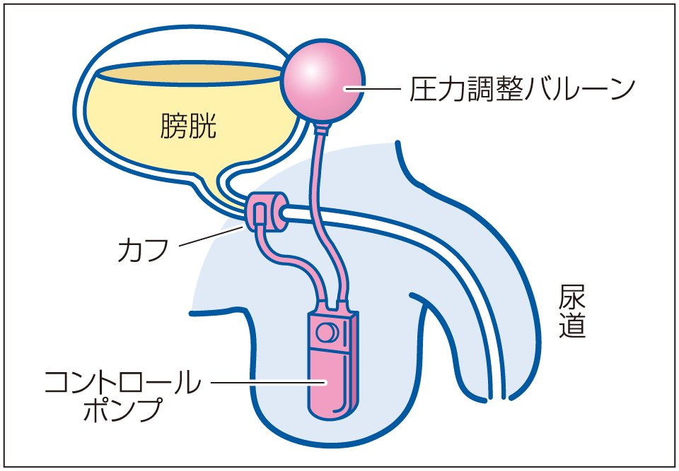 人口尿道括約筋の仕組み