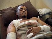 　イスラエルによる病院攻撃で負傷し、治療を受けるパレスチナのテレビカメラマン＝２６日、パレスチナ自治区ガザ（ゲッティ＝共同）