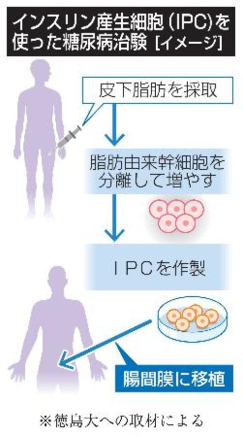 　インスリン産生細胞（ＩＰＣ）を使った糖尿病治験（イメージ）