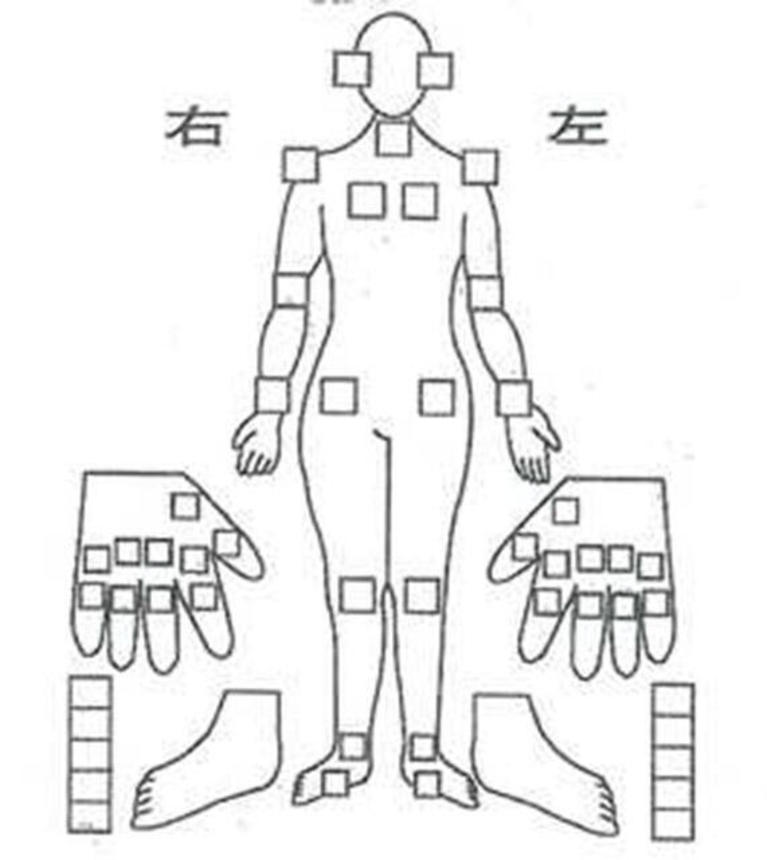 医師がチェックシートに腫れ、痛みのある関節を記入する