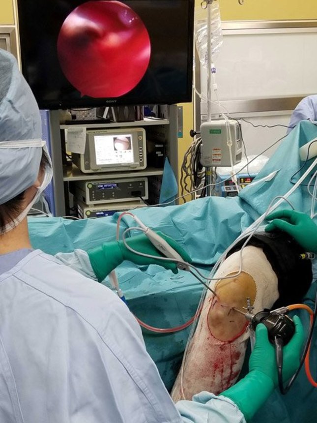 朝日大学病院で行われた膝関節の鏡視下手術（筆者提供）
